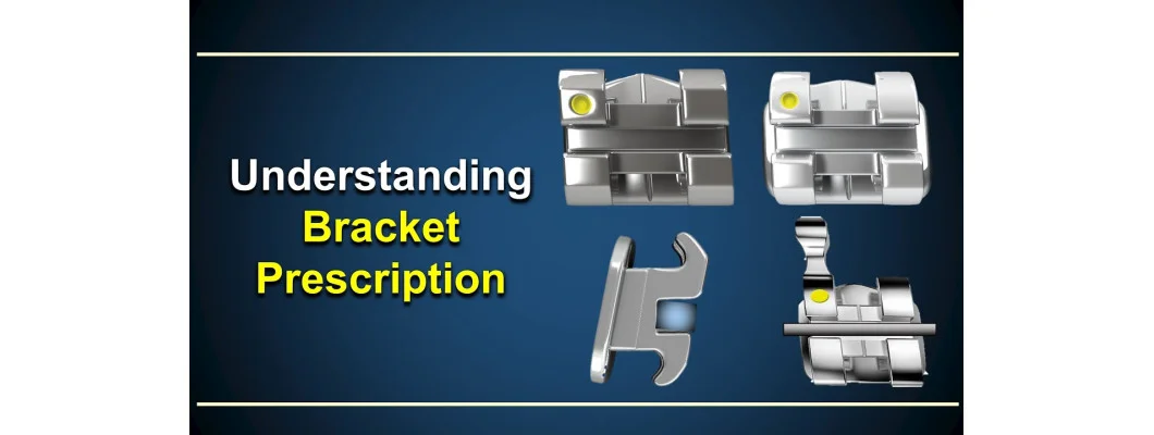 فهم وصفات الحاصرات التقويمية