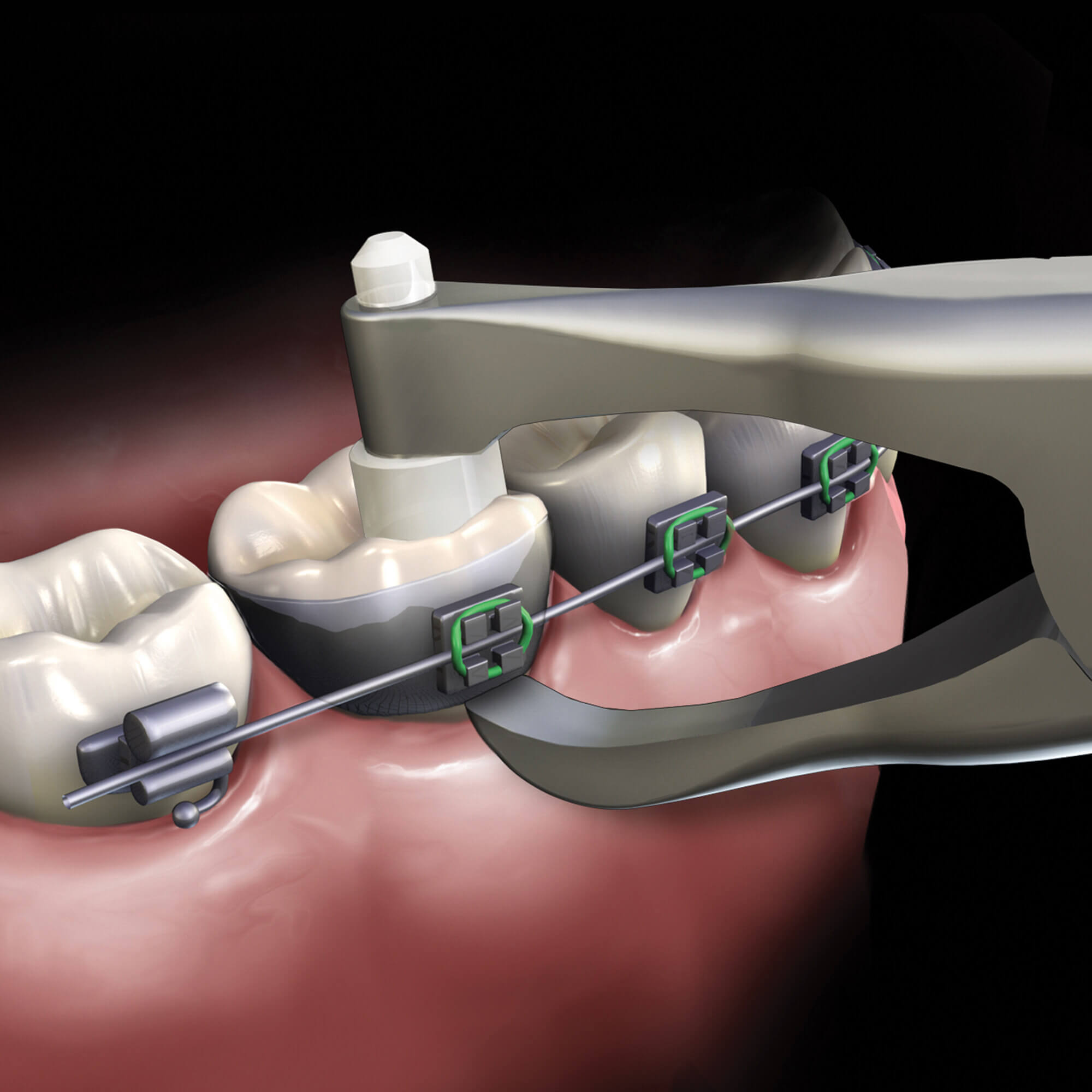 صورة المنتج