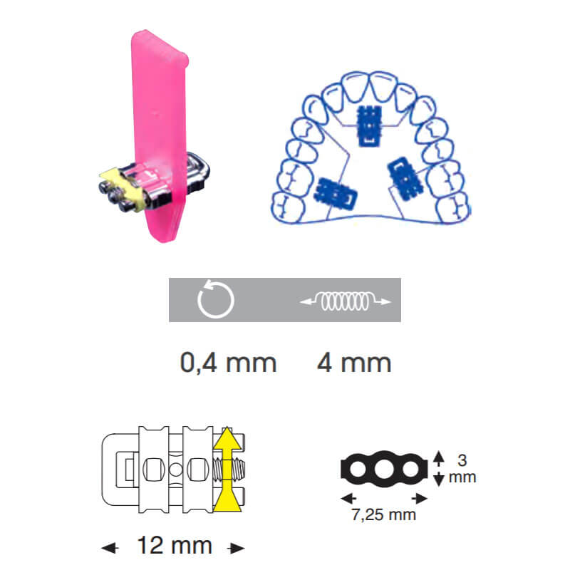 Micro Sectional Screws, U-Straight, Upper, 12 mm