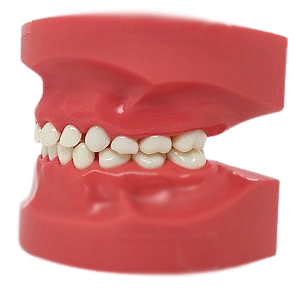Nissin Pediatric Dental Model, Mixed Dentition, 24 Teeth, Hard Gingiva