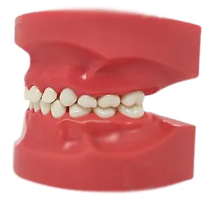 Nissin Pediatric Dental Model, Mixed Dentition, 24 Teeth, Hard Gingiva